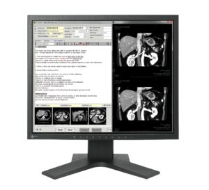 MX194