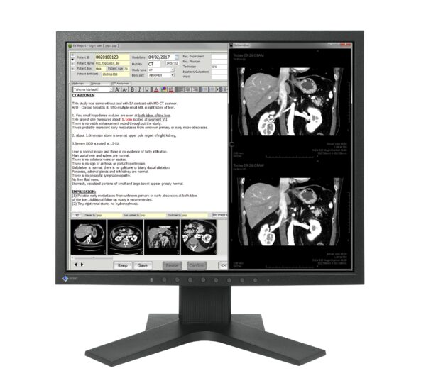 MX194