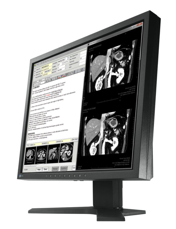 MX194 - immagine 4