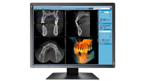 MX217-HB - immagine 5